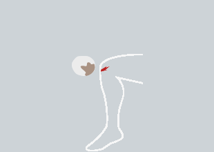 wound-expert-advice-1