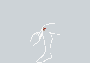 wound-expert-advice-2
